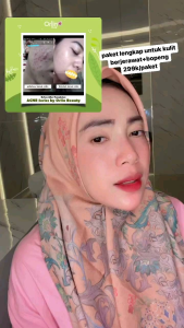 Paket Acne Glowing Orlin Beauty mempercepat pengeringan jerawat ringan dan meradang /bpom