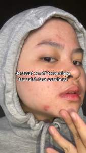 Glad2Glow Centella Salicylic Acid Acne Gel Cleanser 30ml|Glad2Glow Facial Wash Acne G2G pencuci muka wajah berjerawat