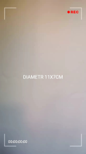 Ring Burger DM 11CM TINGGI 5*6*7 CM Small Round Mousse Ring Baking Cake Stainless