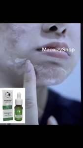 Vi Tảo Peel Bong Da Mặt Siêu Mạnh Hết Nám Tàn Nhang