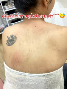 1 แถม 1🔥 (แถมถุงตีฟอง)สบู่พลูคาวออแกนิคสูตรเย็นลดอาการคันภูมิแพ้ผิวหนัง