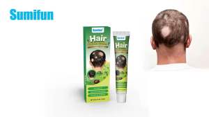 Hair Growth Cream - Hair regrowth Keep your scalp healthy For hair loss symptoms pelebat rambut anti rambut gugur nipis