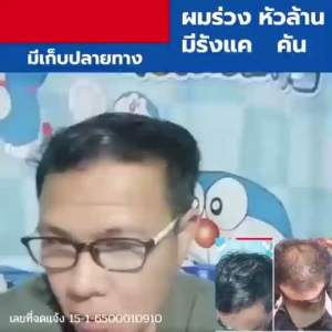 🔥 ผมบางตรงกลาง หัวล้านเป็นจุด ใส่หมวกกันน็อคบ่อย หรือผมร่วงหลังคลอด 🔥 แชมพูสมุนไพรคุณยาย  ลดผมร่วงเฉพาะจุด กระตุ้นผมใหม่ สมุนไพรไทย 17 ชนิด ฟื้นฟูรากผม ใช้ได้ทุกเพศ ปลอดภัย