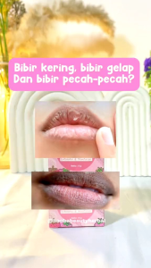 Lip Scrub Exfoliator & Moisturizer Bibir SR12 Angkat Sel Kulit Mati 6gr