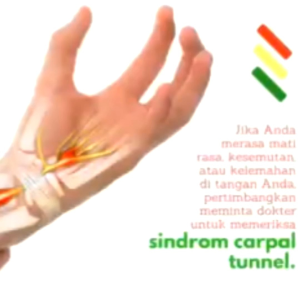 Pelindung Pergelangan Tangan Adjustable Wrist Protector 1 PCS - Black