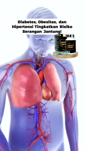 Obat Penyumbatan Jantung Terbaik Di Kelasnya Obat Jantung Bengkak Obat Jantung Bocor Xerdiove Nakara Herbal Ampuh 100% Original BPOM