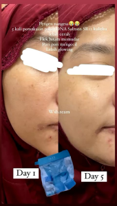 PAKET DNA SALMON SR12 - DNA SALMON SERIES SR12 - Paket Wajah Glowing DNA SALMON SR12