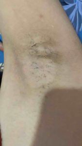 SÉT LỘT BIKINI NÁCH MÔNG BẸN - NƯỚC LỘT COZY cao cấp