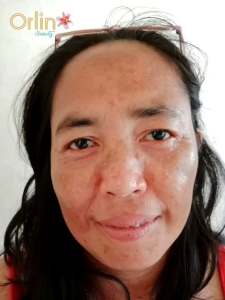 DAY CREAM FLEK PLATINUM MELEMBABKAN WAJAH MENGANDUNG SUNSCREEN SPF 50