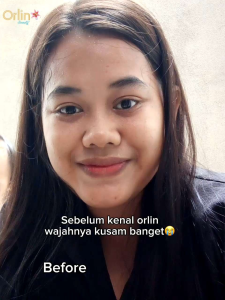 SERUM REJUVENATION ORLIN BEAUTY MENCERAHKAN MELEMBABKAN WAJAH