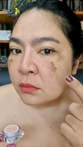 คอนซีลเลอร์เลดี้อาย