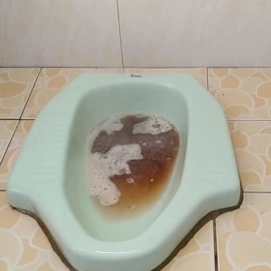 OBAT SALURAN KAMAR MANDI MAMPET & WC MAMPET PALING LARIS