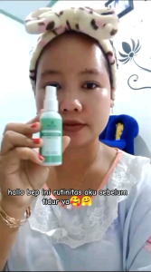 Nezzmg Skincare Reguler Acne # Untuk Wajah Sensitif Dan Berjerawat