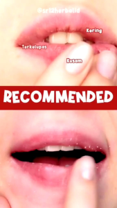 BEST SELLER!!! LIP SCRUB SR12/ LIPCARE SR12 ORIGINAL / LIP GLOW SR12/ HERBAL / BPOM / PELEMBAB BIBIR / BIBIR KERING / PECAH PECAH / HITAM