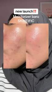 [NEW LAUNCH] SKINTIFIC Symwhite 377 Dark Spot Moisturizer Gel 30g Cream Menyamarkan Flek Hitam for Mencerahkan wajah