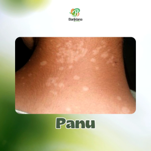 SABUN SULFUR Mengatasi Gatal Panu Eksim Herpes Scabies Kadas Kurap dan Penyakit Kulit Lainnya - 60 gr