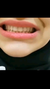 COD GIGI PALSU ATAS BAWAH ORIGINAL TERLARISS TINGGAL PASANG