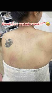 ก่อนหมดโปร⚠️ซื้อ3 แถม 1 สบู่ผื่นคัน สิว แพ้น้ำ แพ้เหงื่อ สบู่คาวตองสมุนไพร ส่งเร็วมีบริการเก็บเงินปลายทาง