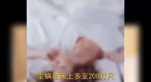 Pek Penyingkiran Hama Mugwort 艾草除螨包 (3袋30小包)  脸上长痘痘，头发容易脱落，头皮出油，皮肤红痒，这是螨虫太多啦！快试试这个植物祛螨包，消除螨虫保护您及您的家人❤ Removal Pack