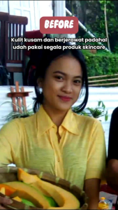 Best Seller Paket Scinecare j9beauty Serumcreamfacialwash