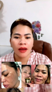 Jelly Kedas Beauty Emas: Perawatan Wajah Alami