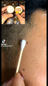 Lady May  dark spots cream မှဲ့ဖျက်ဆေး