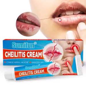SUMIFUN LIPS TREATMENT CHEILITIS CREAM Krim rawatan bibir kering bibir mengelupas merahkan bibir kusam licinkan melembab bibir