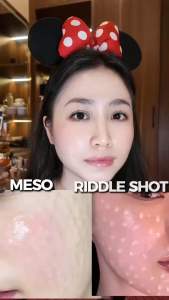 Serrum B5 Phục Hồi Da Mỏng Yếu Sau Pel Tái Tạo Hộp 30 ml