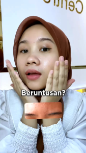 B ERL Acne Series Pouch Very Berry Acne Treatment Oil Control Series Berl Berlcosmetics Paket Perawatan Wajah Kulit Berminyak
