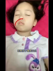 Adult and Kids Sleep Strips 30PCS ANTI SNORE MOUTH TAPE SLEEP STRIPS ADULT KIDS Pita pelekat mulut anti berdengkur Mengurangkan bunyi dengkur semasa tidur
