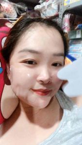 Nạ nâng cơ seomou đài loan ( hộp 5 miếng)cho vùng má