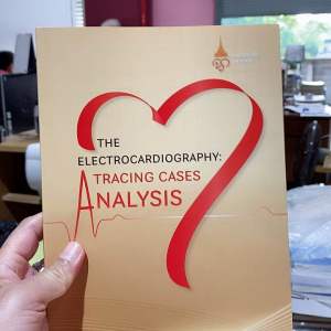 9786165888851 THE ELECTROCARDIOGRAPHY: TRACING CASES ANALYSIS(