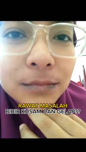 Dark to Pinkish Lips Magic Treatment