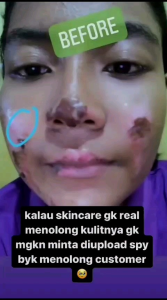 Paket Skincare Flek Platinum Orlin Beauty: Mencerahkan Wajah & Mengencangkan Kulit