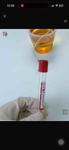 Blood butterfly needle Vacuum Blood Collection Tube Disposable PET Glass Red Cap No Additives Serum Biochemical yellow cap 3ml /5ml