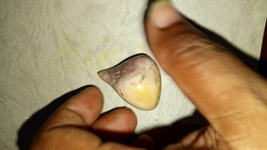 batu tarikan alam (ker3jek!an dan p3ngas!han)