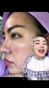 Ready paket DNA SALMON+CAVIAR MOISTURIZER DEEP by Bella Shofie