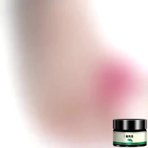 Kem bôi gút khớp gút ngôn tay ngón chân giảm đau