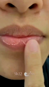 LIP CARE SR12 PELEMBAB BIBIR ATASI BIBIR HITAM ATASI BIBIR PECAH PECAH