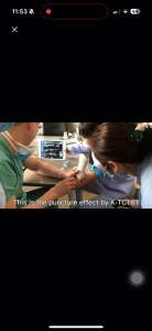 [Ready Stock] Official Karestar Medical Colour Doppler Ultrasound Wifi Ultrasonic Probe 3 in 1