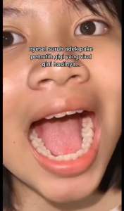 Odol Orecare: Pasta Gigi Pemutih Herbal untuk Kesehatan Gigi