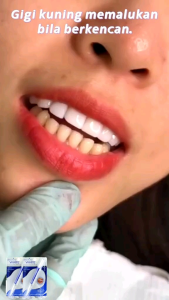 Cod - Pemutih Gigi Instant / Dazzling White / Teeth Whitening Pen - ORIGINAL