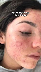 Jglow PREMIUM JELLY LEMON JGLOW - JGLOW JELLY LEMON SNOW GEL