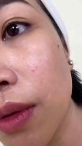 Gluta Pink Face Serum Original Thailand (Serum Wajah Pemutih Glowing Flek Hitam Mencerahkan Bekas Jerawat)