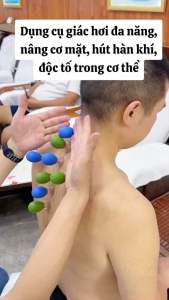 cốc giác hơi ( 5 cốc )