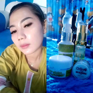 Paket Brightening Platinum + Serum Rejuvenation Orlin Beauty ( free jelly pink seharga 40.000)