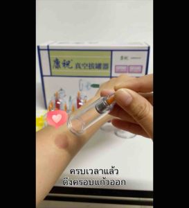 ครอบแก้วสุญญากาศ ยี่ห้อค้างจู้ Carezoe ใช้สำหรับสปาและผ่อนคลายกล้ามเนื้อ Carezoe Vacuum Cupping By Fangkhem