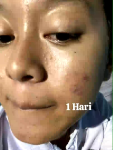 Paket Venora Skincare Farmasi/BPOM Free Bonus