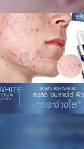 White Serum Hi SpeedX10 by Natcha Beaute 30ml