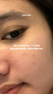 BG Skin Paket 5X Ceramide Calming Hydrating Solution Set